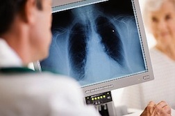 x-ray picture