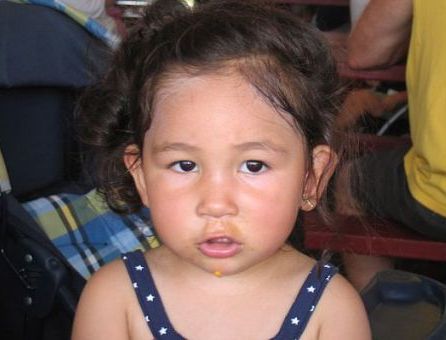 picture of cholesterol